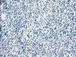 FOSL1 Antibody in Immunohistochemistry (Paraffin) (IHC (P))