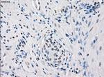 FOSL1 Antibody in Immunohistochemistry (Paraffin) (IHC (P))