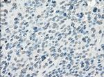 FOSL1 Antibody in Immunohistochemistry (Paraffin) (IHC (P))