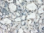 FOSL1 Antibody in Immunohistochemistry (Paraffin) (IHC (P))