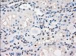 FOSL1 Antibody in Immunohistochemistry (Paraffin) (IHC (P))