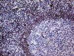 FOSL2 Antibody in Immunohistochemistry (Paraffin) (IHC (P))