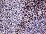 FOSL2 Antibody in Immunohistochemistry (Paraffin) (IHC (P))