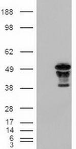 FOXA2 Antibody in Western Blot (WB)