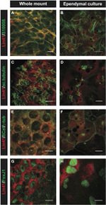 FOXJ1 Antibody in Immunohistochemistry (IHC)