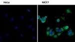 FOXO3A Antibody in Immunocytochemistry (ICC/IF)