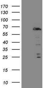 FOXO4 Antibody in Western Blot (WB)