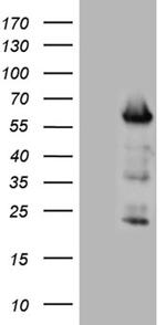 FOXO4 Antibody in Western Blot (WB)