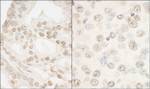 FOXP1 Antibody in Immunohistochemistry (IHC)