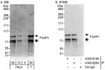 FOXP1 Antibody in Western Blot (WB)