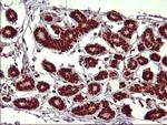 FOXP1 Antibody in Immunohistochemistry (Paraffin) (IHC (P))