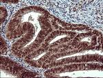 FOXP1 Antibody in Immunohistochemistry (Paraffin) (IHC (P))