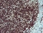 FOXP1 Antibody in Immunohistochemistry (Paraffin) (IHC (P))