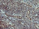 FOXP1 Antibody in Immunohistochemistry (Paraffin) (IHC (P))