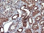 FOXP1 Antibody in Immunohistochemistry (Paraffin) (IHC (P))