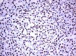 FOXP1 Antibody in Immunohistochemistry (Paraffin) (IHC (P))