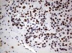 FOXP1 Antibody in Immunohistochemistry (Paraffin) (IHC (P))