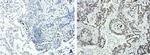 FOXP1 Antibody in Immunohistochemistry (Paraffin) (IHC (P))