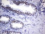 FOXP1 Antibody in Immunohistochemistry (Paraffin) (IHC (P))