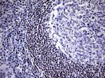 FOXP1 Antibody in Immunohistochemistry (Paraffin) (IHC (P))