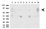 FOXP1 Antibody in Western Blot (WB)