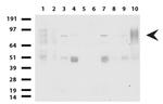 FOXP1 Antibody in Western Blot (WB)