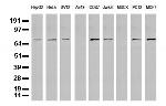 FOXP1 Antibody in Western Blot (WB)