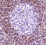 FOXP1 Antibody in Immunohistochemistry (Paraffin) (IHC (P))