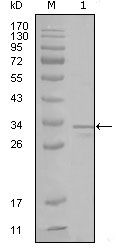 FRK Antibody in Western Blot (WB)