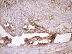 FSCN1 Antibody in Immunohistochemistry (Paraffin) (IHC (P))