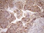 FSCN1 Antibody in Immunohistochemistry (Paraffin) (IHC (P))