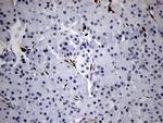 FSCN1 Antibody in Immunohistochemistry (Paraffin) (IHC (P))