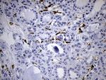 FSCN1 Antibody in Immunohistochemistry (Paraffin) (IHC (P))