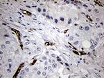 FSCN1 Antibody in Immunohistochemistry (Paraffin) (IHC (P))