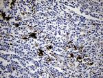 FSCN1 Antibody in Immunohistochemistry (Paraffin) (IHC (P))