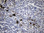 FSCN1 Antibody in Immunohistochemistry (Paraffin) (IHC (P))