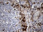 FSCN1 Antibody in Immunohistochemistry (Paraffin) (IHC (P))