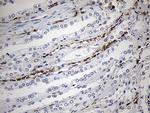 FSCN1 Antibody in Immunohistochemistry (Paraffin) (IHC (P))