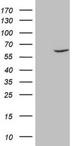 FSCN1 Antibody in Western Blot (WB)