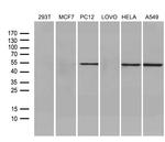 FSCN1 Antibody in Western Blot (WB)