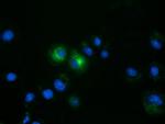 FSHB Antibody in Immunocytochemistry (ICC/IF)