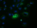 FSHB Antibody in Immunocytochemistry (ICC/IF)