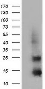 FSHB Antibody in Western Blot (WB)