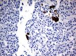 FTCD Antibody in Immunohistochemistry (Paraffin) (IHC (P))