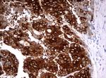 FTCD Antibody in Immunohistochemistry (Paraffin) (IHC (P))