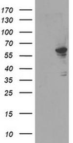 FTCD Antibody in Western Blot (WB)