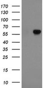 FTCD Antibody in Western Blot (WB)