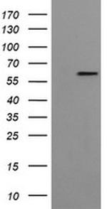 FTCD Antibody in Western Blot (WB)