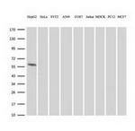 FTCD Antibody in Western Blot (WB)