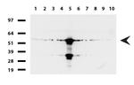 FTCD Antibody in Western Blot (WB)